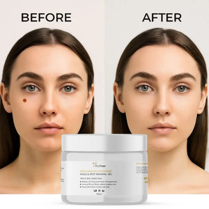 Mole & Spot Care Gel