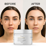 Mole & Spot Care Gel