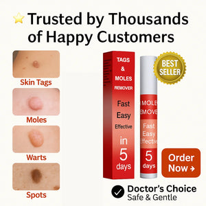 Advanced Moles, Tags & Spot Remover Gel  (BUY 1 GET 1 FREE)