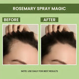 <p>Rosemary Water, Hair Spray For Regrowth </p> <p style="font-size: 15px; line-height: 1.5;">   Free Cash on Delivery 3 - 5 Days <br>   5k+ Sold last month <br> ⭐️⭐️⭐️⭐️⭐️4.8/5 (12,600+ REVIEWS) <br>🔥 BUY 1 GET 1 FREE🔥</p