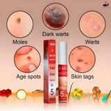 Advanced Moles, Tags & Spot Remover Gel  (BUY 1 GET 1 FREE)