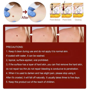Advanced Moles, Tags & Spot Remover Gel  (BUY 1 GET 1 FREE)