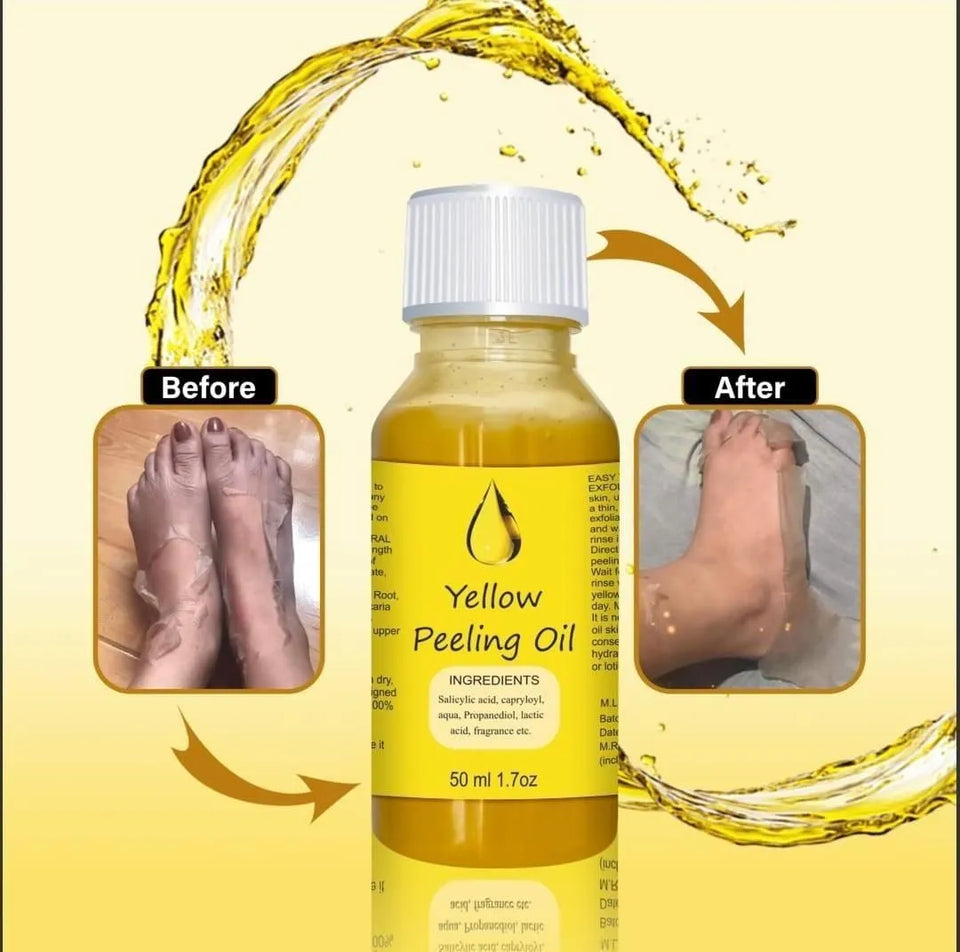 <p>YELLOW®- PEELING OIL FOR DARK SKIN</p> <p style="font-size: 15px; line-height: 1.5;">   Free Cash on Delivery 3 - 5 Days <br>   2k+ Sold last month <br> ⭐️⭐️⭐️⭐️⭐️4.7/5 (12,600+ REVIEWS)</p
