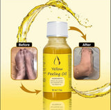 <p>YELLOW®- PEELING OIL FOR DARK SKIN</p> <p style="font-size: 15px; line-height: 1.5;">   Free Cash on Delivery 3 - 5 Days <br>   2k+ Sold last month <br> ⭐️⭐️⭐️⭐️⭐️4.7/5 (12,600+ REVIEWS)</p