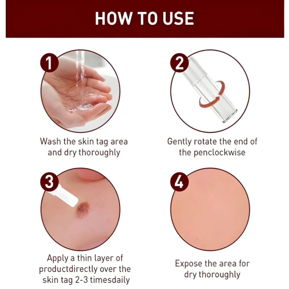 Advanced Moles, Tags & Spot Remover Gel  (BUY 1 GET 1 FREE)