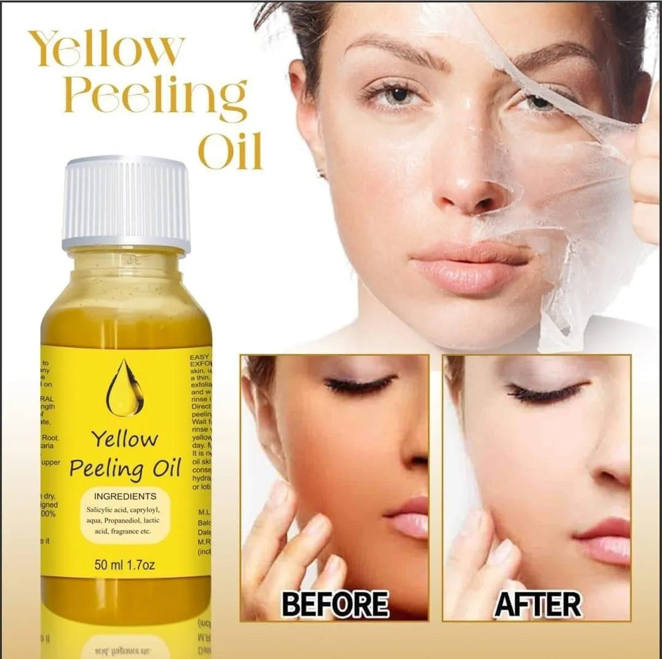<p>YELLOW®- PEELING OIL FOR DARK SKIN</p> <p style="font-size: 15px; line-height: 1.5;">   Free Cash on Delivery 3 - 5 Days <br>   2k+ Sold last month <br> ⭐️⭐️⭐️⭐️⭐️4.7/5 (12,600+ REVIEWS)</p