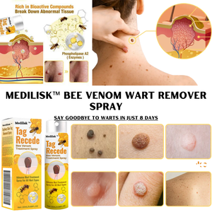 Bee Venom Wart Remover Spray 30ml