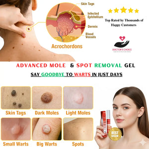 Advanced Moles, Tags & Spot Remover Gel  (BUY 1 GET 1 FREE)